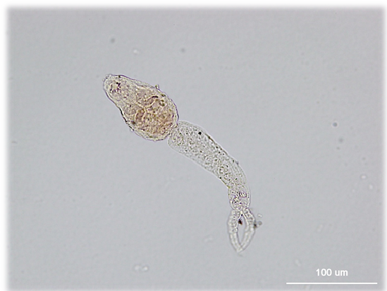 schistosomiasis etimológia